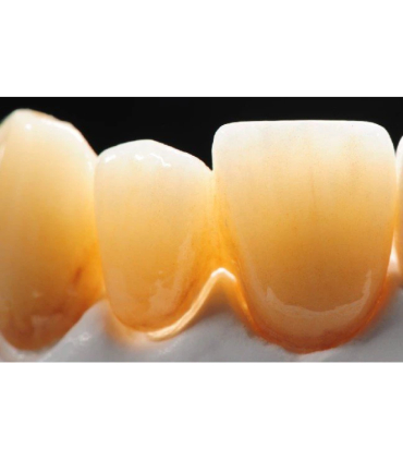 زیرکونیای چند لایه سه بعدی کینگ سی اچ مدل 3D -M برند KingCH